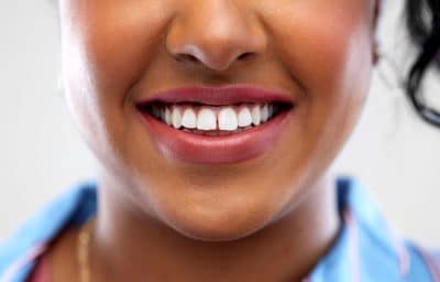 close up smile of a woman with a gap in her front teeth