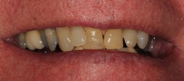 Male patient before dental treatment